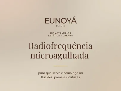 Radiofrequência microagulhada: para que serve e como age na flacidez, poros e cicatrizes